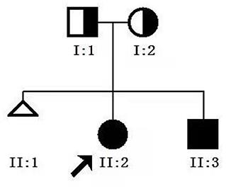 Congenital Short-Bowel Syndrome Is Associated With a Novel Deletion Mutation in the CLMP Gene: Mutations in CLMP Caused CSBS